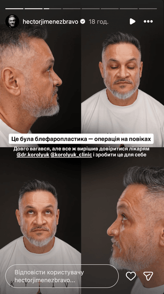 ектор хіменес браво 3 Ектор Хіменес-Браво